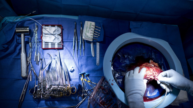 When it comes to organ donation, women may be more likely to give than to receive