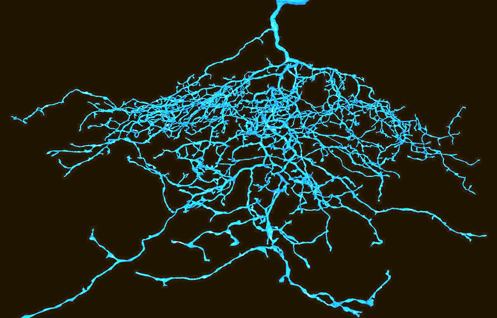 Anyone can play EyeWire and in the process participate in mapping the 3D structure of neurons.