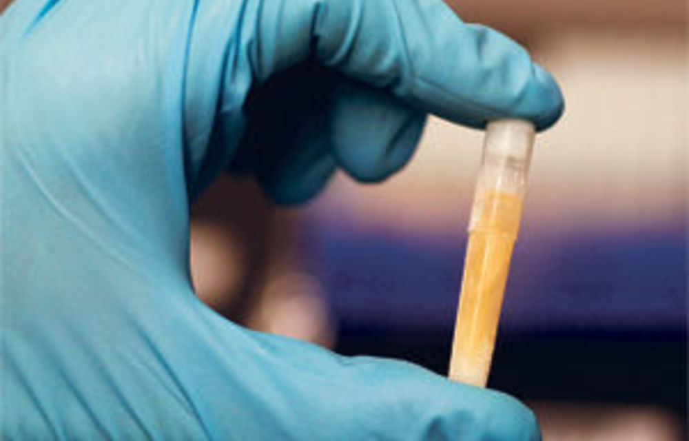 Genes predict risk