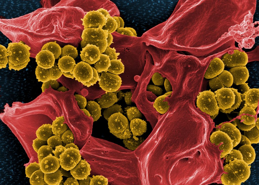 Video: How to beat superbugs on a tight budget